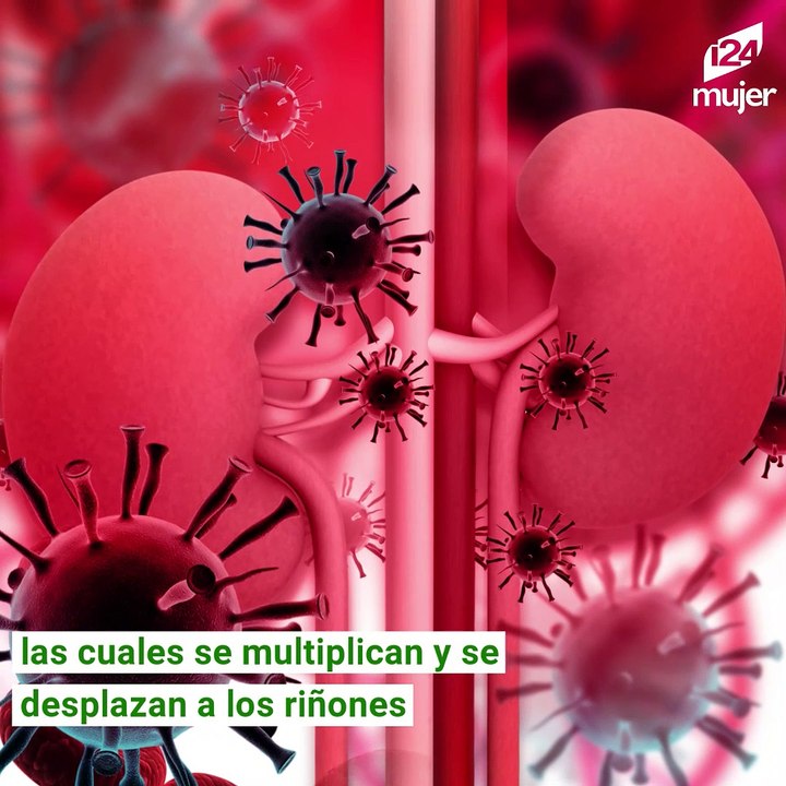 Infección renal: síntomas, causas y riesgos