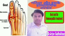 Gout and its Homoeopathic treatment.l गठिया और इसके होम्योपैथिक उपचार l By Dr.Arjun Sadhukhan.