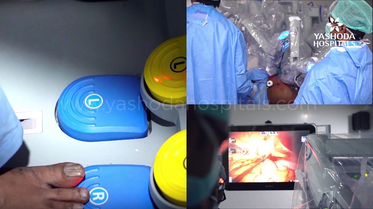 Robotic Partial Nephrectomy Surgery for Kidney Cancer | Yashoda Hospitals