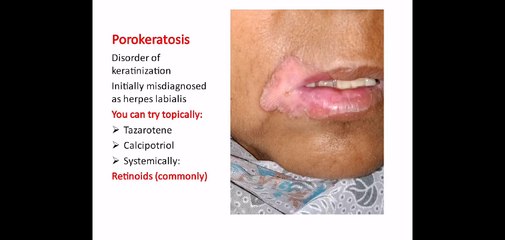 Different cases in Dermatology