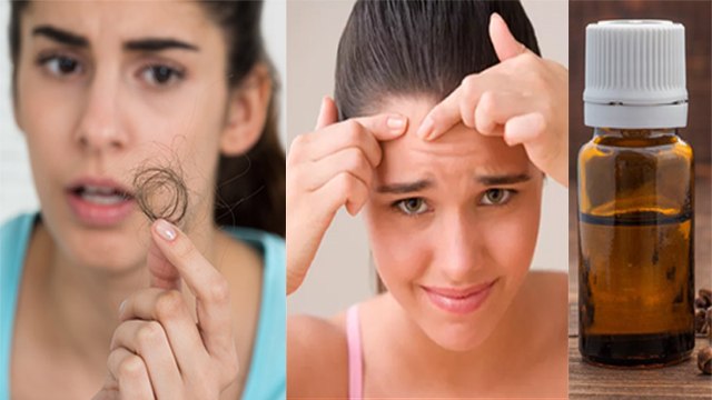 लौंग के तेल के जादुई फायदे |Clove Oil Benefits in Hindi|Clove Oil Benefits for Skin and Hair|Boldsky