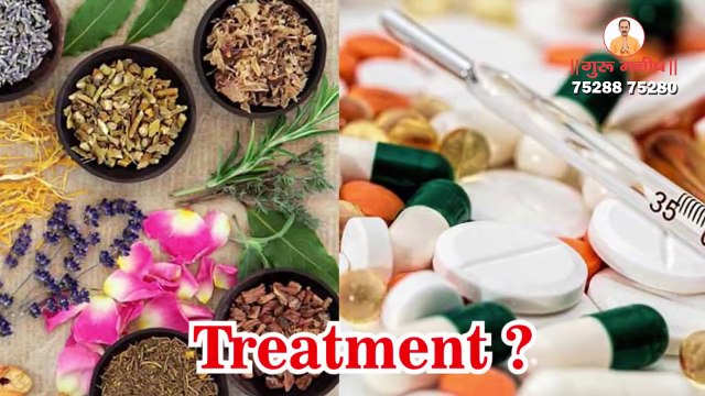 Vitiligo - Leucoderma - Safed Daag - Symptoms - Causes - Ayurvedic - Treatment