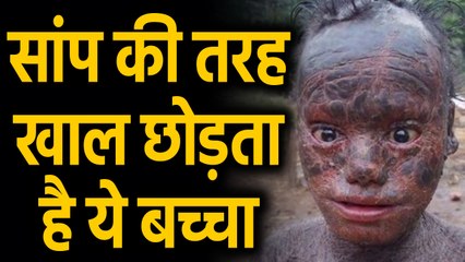 Odisha: 10 साल के Jagannath को लोग बुलाते हैं Human Snake, जानिए क्या है वजह | वनइंडिया हिंदी