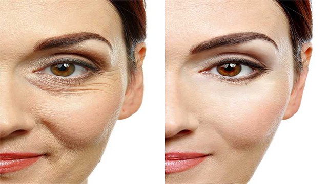 स्किन की झुर्रियों को दूर करता है अदरक | Ginger Home Remedies for Wrinkles | Boldsky