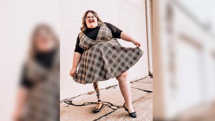 This Amputee Has Created a Body Positive Blog to Help Normalize Disabilities