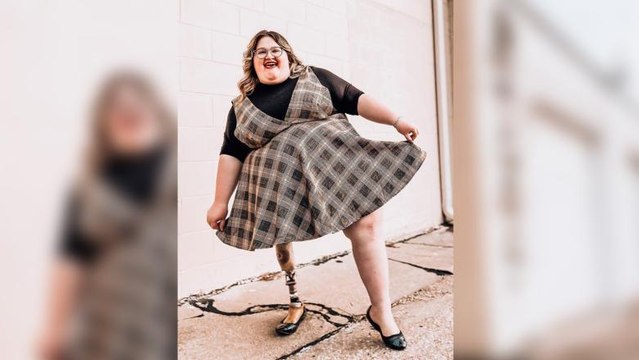 This Amputee Has Created a Body Positive Blog to Help Normalize Disabilities