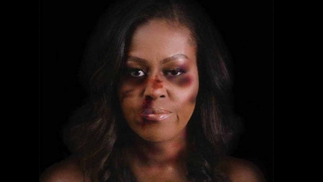 Michelle Obama y otras mujeres golpeadas, así es esta campaña contra violencia