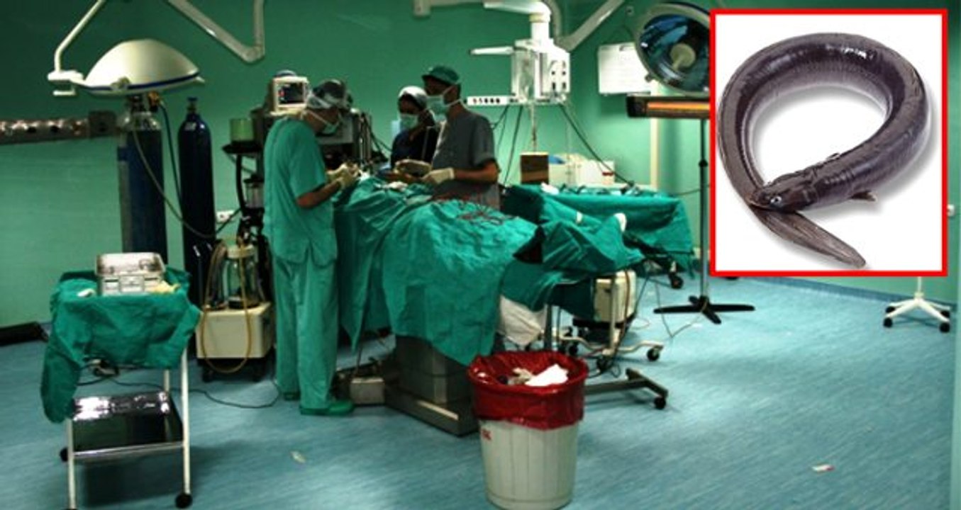 Kabızlık sorununu 'yılanla' çözmek istedi, gerçek röntgende ortaya çıktı! Doktorlar bile şoke oldu