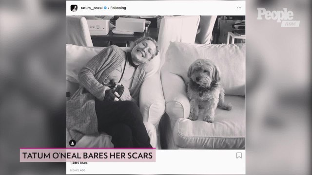 Tatum O'Neal Shares Candid Photo of Her Scars as She Talks About Living with Rheumatoid Arthritis