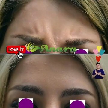 Botox in New Jersey | Anara MedSpa & Cosmetic Laser Center