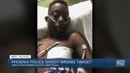 Valley teen in hospital after being misidentified by Phoenix police as a suspect in armed robbery