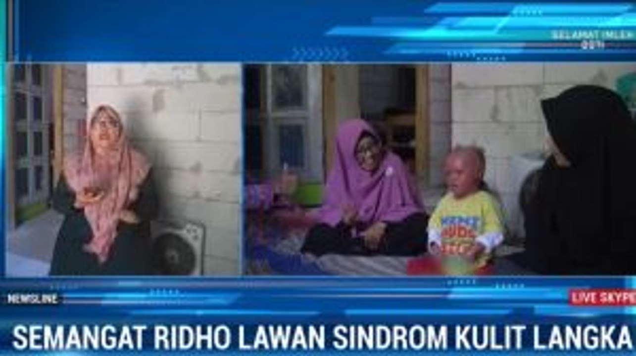 Balita di Banyumas Berjuang Melawan Sindrom Kulit Kura-kura