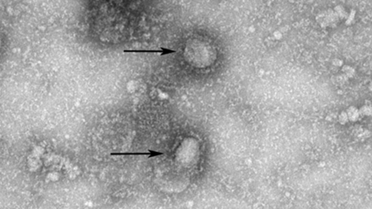 Wuhan virus: second death reported in China as Japan finds first case