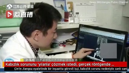 Kabızlığını yılanla çözmek istedi, gözünü ameliyat masasında açtı!