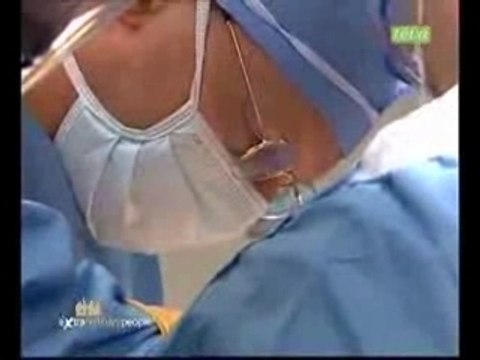 LES SOEURS SIAMOISES BICEPHALES SOEURS 2