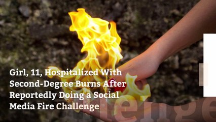 Girl, 11, Hospitalized With Second-Degree Burns After Reportedly Doing a Social Media Fire Challenge