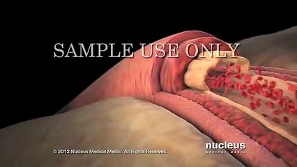 What is blood pressure||BP