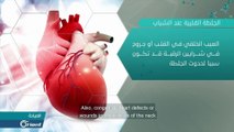 الجلطة القلبية عند الشباب.. ما هي الأسباب وكيف يمكن الوقاية منها؟ - العيادة