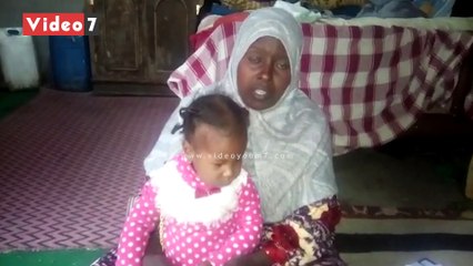 "سيبها علينا" مأساة طفلة ولدت بعيب خلقى بالبصر.. ووالدتها تناشد علاجها