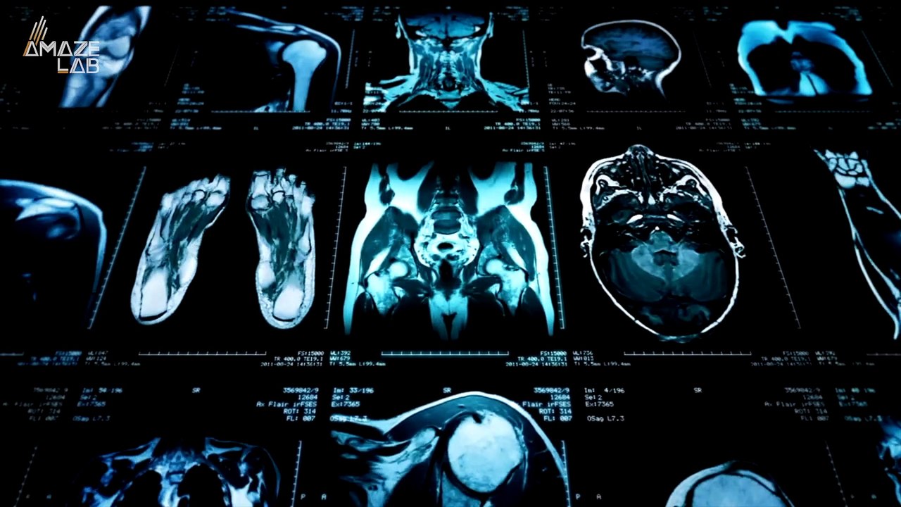 New Tech Can Observe the Brain & Heart Simultaneously