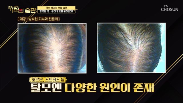 [기적의 습관 11회] 빗질! 잘못하면 탈모를 유발 할 수 있다? 두피에 좋은 빗질 TIP