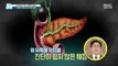 [HEALTHY] sticky mucous sac 'pancreatic cyst', 기분 좋은 날 20200122