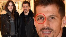 Emre Belözoğlu eşiyle görüntülendi, mor gözü şaşırttı