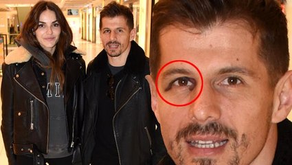 Emre Belözoğlu eşiyle görüntülendi, mor gözü şaşırttı