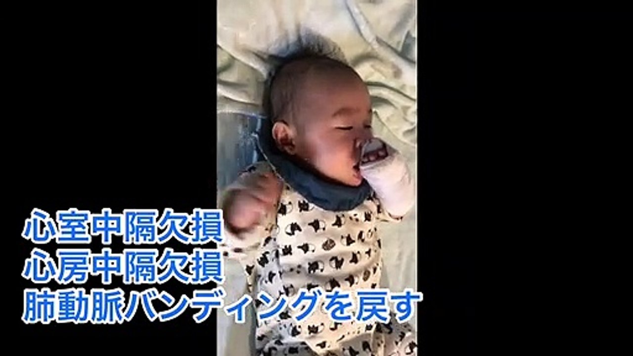 【修正3ヶ月】心臓手術前日のパパの心境を話す