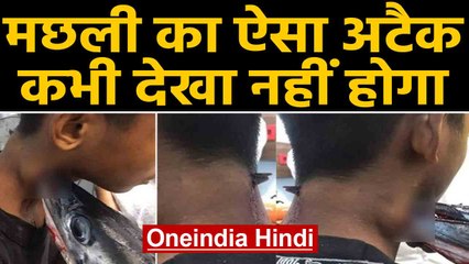 Needlefish ने इस लड़के पर ऐसे किया Attack, तस्वीरें देखकर हो जाएंगे हैरान | Oneindia Hindi