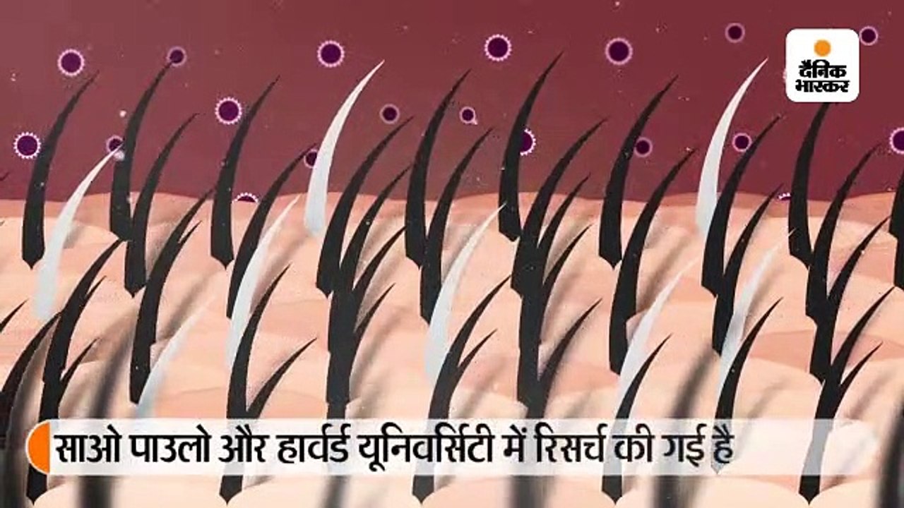 तनाव से बाल हो रहे सफेद, वैज्ञानिकों का दावा, स...