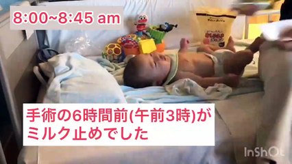 【修正3ヶ月】心臓手術当日の赤ちゃんの様子|心室中隔欠損(VSD)