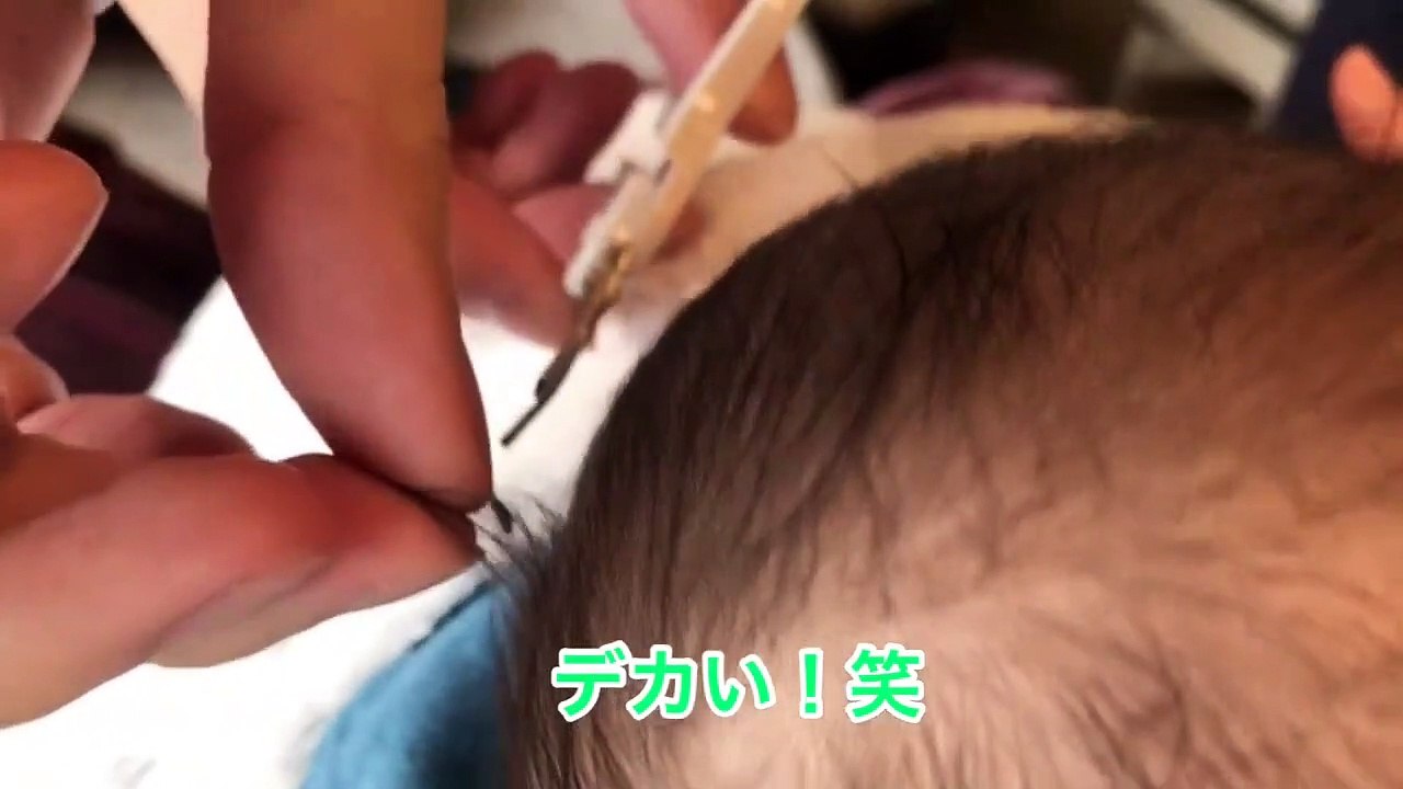 【修正4ヵ月】アリンコ退治！〜赤ちゃんの髪の毛をきる〜
