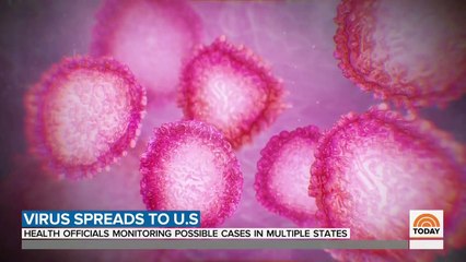 Will Chinese coronavirus Spread In US What You Need To Know - TODAY