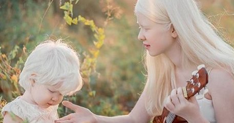 Ces deux sœurs nées albinos, de 12 ans d'écart, surprennent de par leur beauté