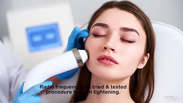 Things to Know About Radio Frequency Treatment for Tightening Skin