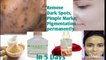 How to get rid from Dark Spot, Pimple Marks,  Pigmentation, Remove permanently within 5days only| Apply regular and get clean skin| 1 Remedy solve all skin problems| Natural home made treatment | Don't invest so much money in chemical products| benatural