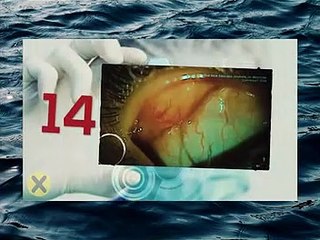 Cosas encontradas dentro de una persona  2 :O