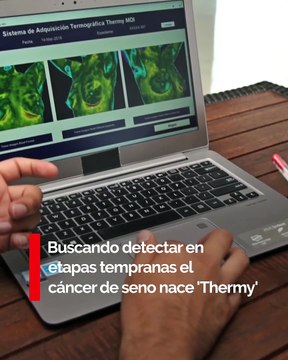 THERMY: Estudio complementario para la detección temprana de cáncer de seno