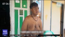 [뉴스터치] '비만 수술·운동' 109㎏ 감량 인도네시아 소년