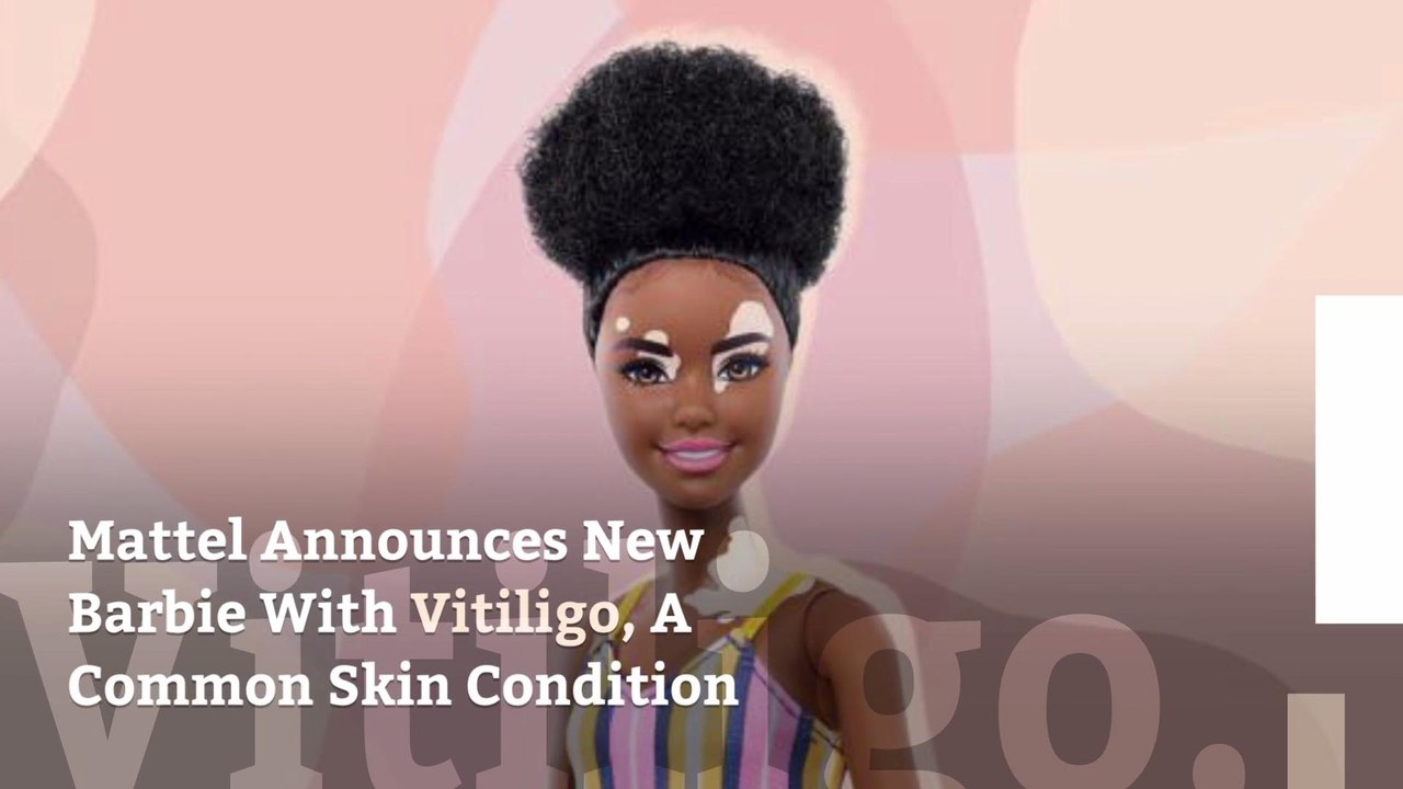 Mattel Announces New Barbie With Vitiligo, A Common Skin Condition