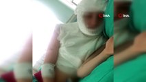 Ümraniye’de üvey kızını kaynar suyla yaktığı iddia edilen üvey annenin ifadesi ortaya çıktı