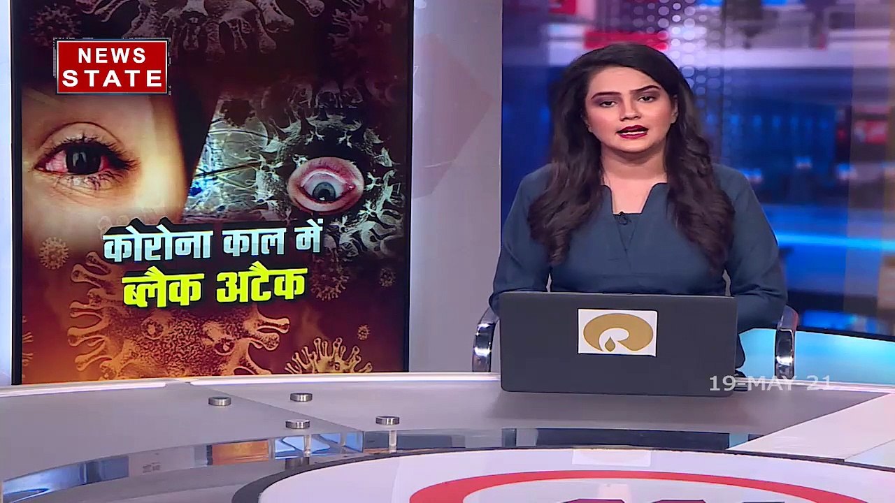 मध्य प्रदेश में लगातार बढ़ रहे है ब्लैक फंगस के मरीज