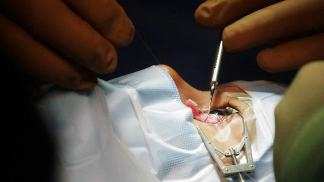 Maharashtra reports 90 deaths due to black fungus