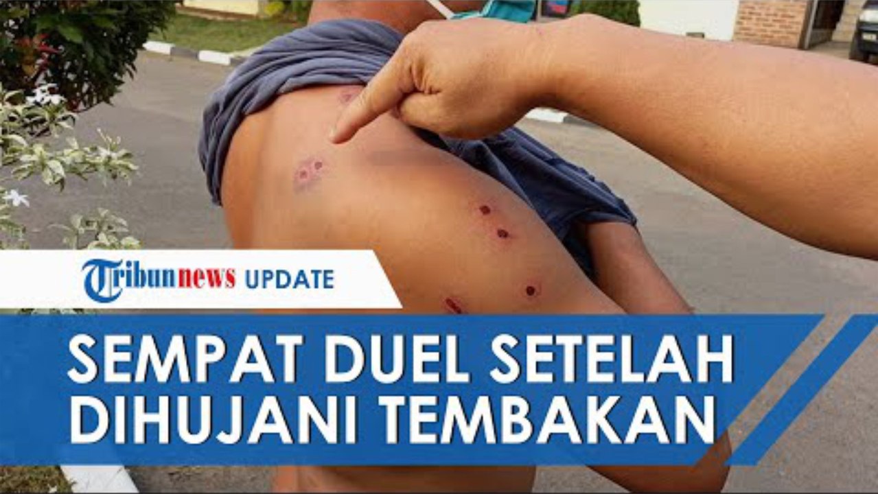 Sopir Taksi Online Sempat Duel Lawan 4 Begal dan Diberondong Tembakan Airsoft Gun, Begini Kondisi