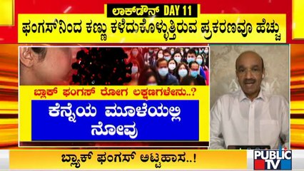 Standalone Eye Hospitals Cannot Treat Black Fungus Infection, Says Dr. Bhujanga Shetty