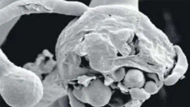 Black Fungus के बाद अब White Fungus ने बरपाया कहर, जानें कितना ज्यादा है खतरनाक | Boldsky