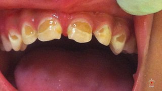 Chalo Adarsh Banie Part-14 Mr. Dental | BAPS VIDEO | SCHOOL PROJECT IN WORLD