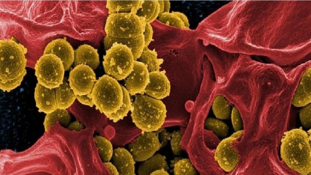 Black Fungus: Maharastra declared it as epidemic