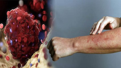 Coronavirus Patient में पहली बार दिखा ये लक्षण, Scientists ने दी चेतावनी | Boldsky